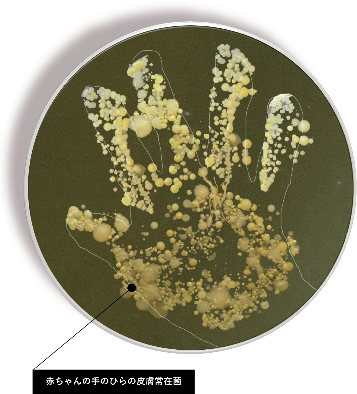 赤ちゃんの手のひらの皮膚常在菌